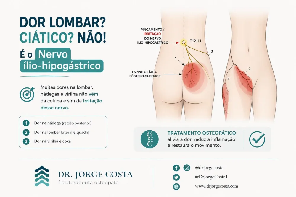 Dor lombar ou dor ciática? Nem sempre. Pode ser o nervo ílio-hipogástrico.