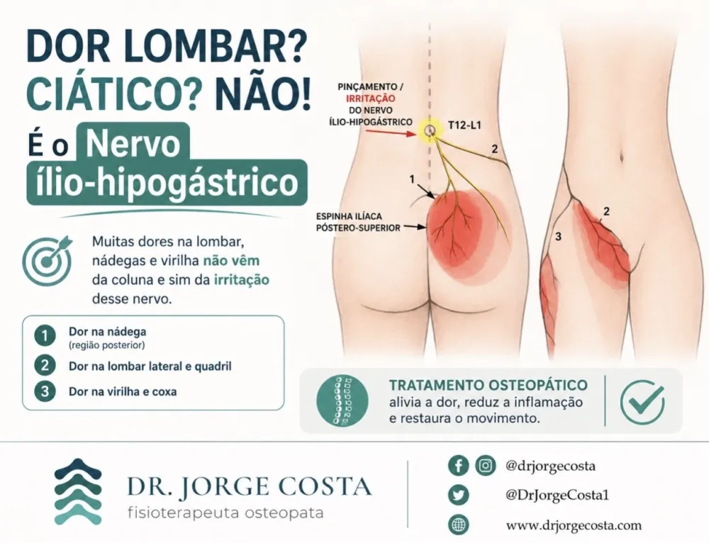Dor lombar ou dor ciática? Nem sempre. Pode ser o nervo ílio-hipogástrico.